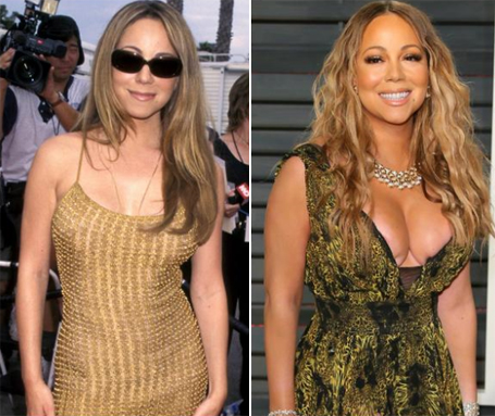 Did Mariah have plastic surgery? Experts weigh in | mcarchives.com